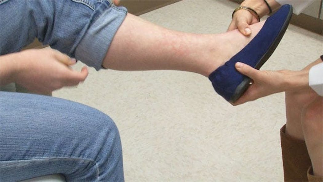 News 9 Producer's Attempt To Stay Warm Leads To 'Toasted Skin Syndrome'